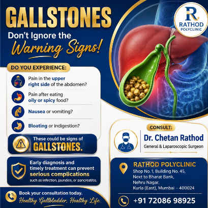 GALLSTONES